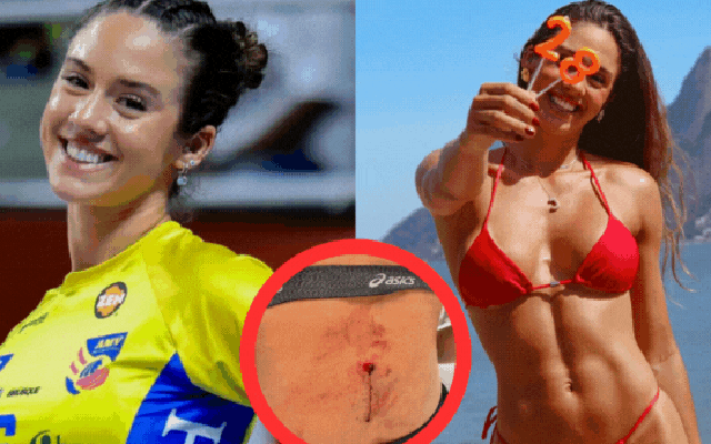 Nữ thần bóng chuyền thoát chết thần kì sau khi bị bắn trúng trong một vụ cướp