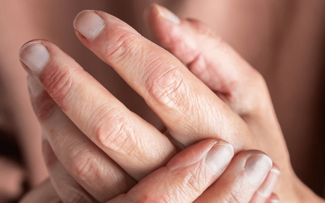 Nhìn tay và chân cũng có thể biết gan bị tổn thương hay không: Đây là 5 dấu hiệu cần lưu ý