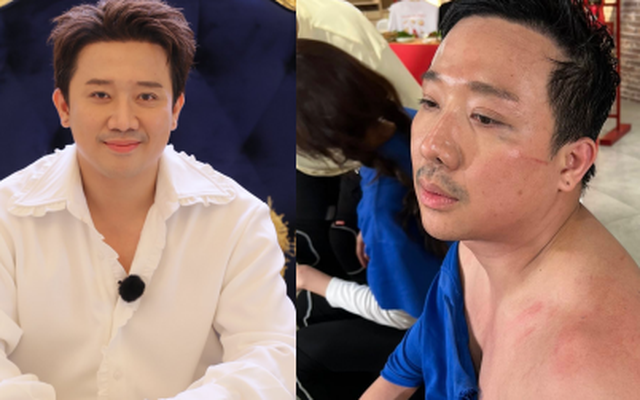 Trấn Thành kiệt quệ