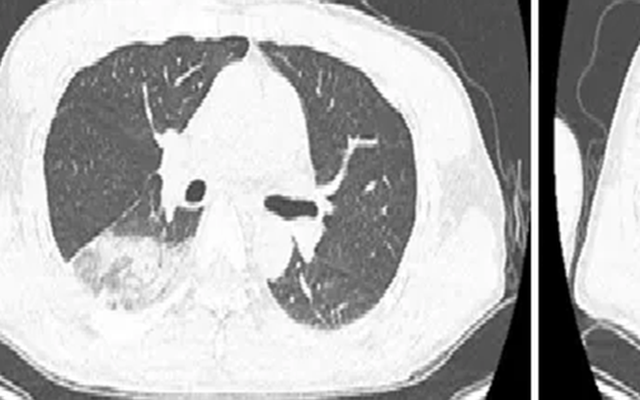 Người đàn ông bệnh nặng vì thích chơi chim