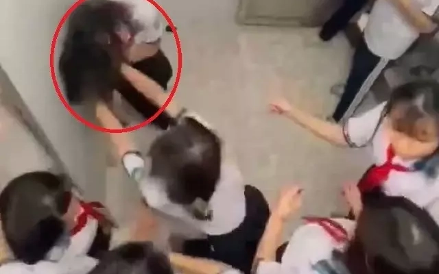 Vụ nữ sinh lớp 8 bị đánh hội đồng trong nhà vệ sinh: Rạn 3 xương sườn