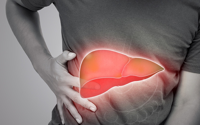 Mắc bệnh gan nhiễm mỡ vì thứ tưởng rằng "lành mạnh"