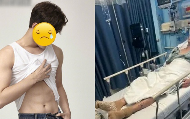 Bi kịch sau cú ngã khiến nam diễn viên bị xe tải cán nát chân, 2 năm lên bàn mổ để giữ mạng