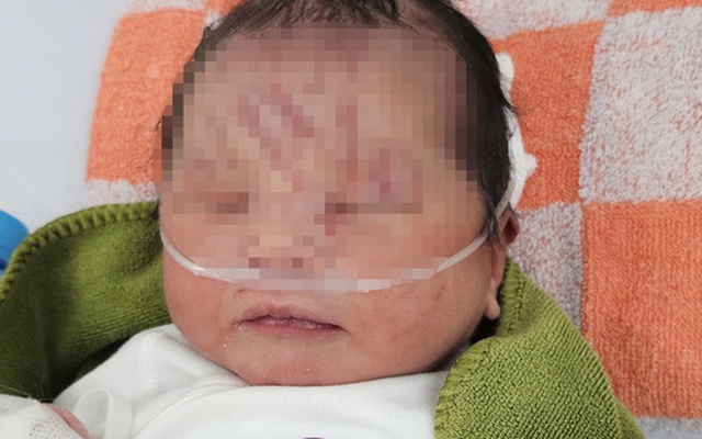 Nhiều người muốn nhận nuôi bé sơ sinh bị bỏ rơi ở Gia Lai