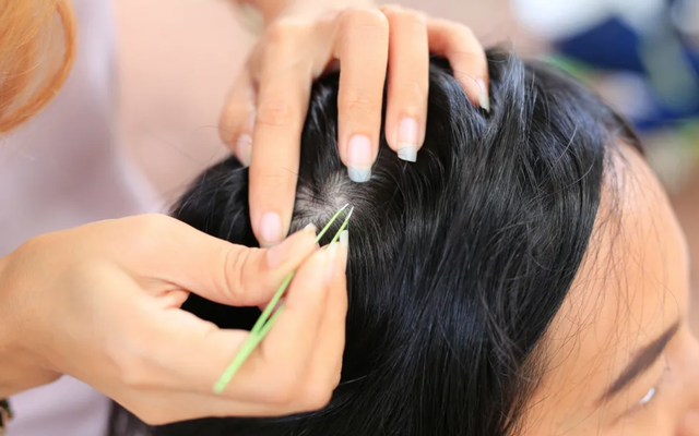 Hóa ra đây là lý do bạn không nên nhổ tóc bạc