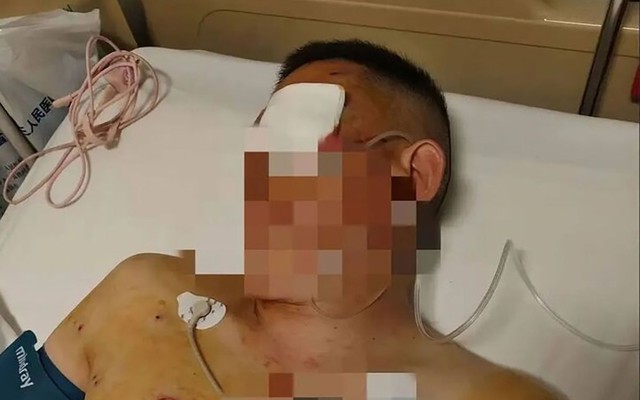 Khách rút tiền vật lộn với tên cướp 20 phút trước ngân hàng, bảo vệ bị tố mặc kệ