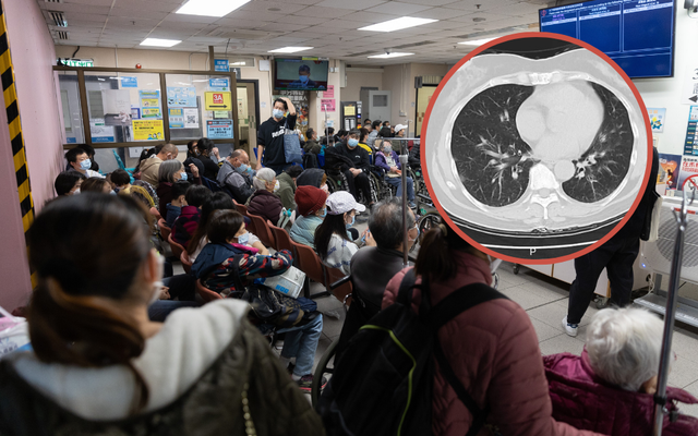 Một nhà 5 người đồng loạt mắc cúm sau chuyến đi chơi, có người biến chứng nặng, trắng phổi vì bỏ lỡ "48 giờ vàng"