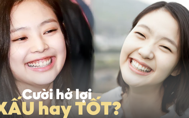 Cười hở lợi trong trong nhân tướng học dự báo điều gì về vận mệnh?