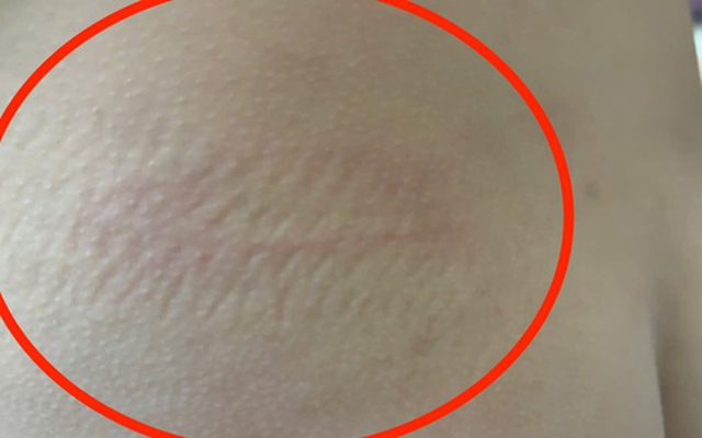 Cô giáo bị tố đánh, xưng "ông - tui" với học sinh lớp 2 ở Nha Trang