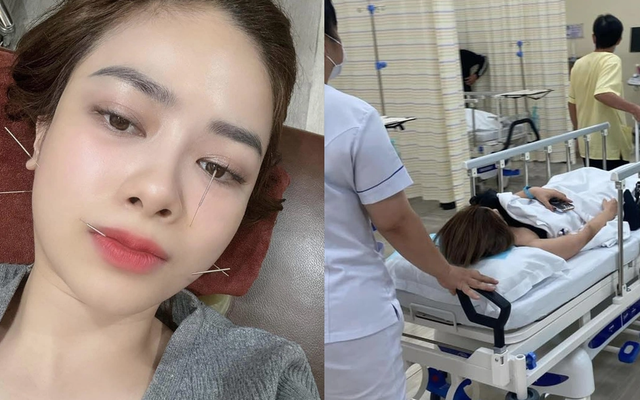 Dương Hoàng Yến cấp cứu trong đêm do liệt dây thần kinh số 7: Bác sĩ liệt kê 4 nguyên nhân hàng đầu
