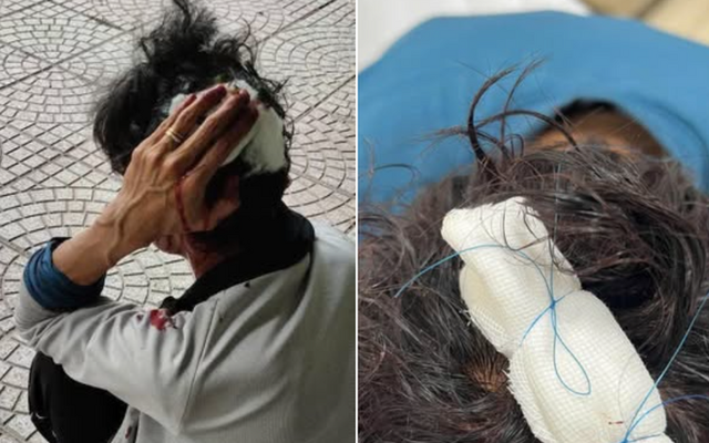 Xác minh vụ nam shipper ở Bình Dương bị chém khi đi giao hàng