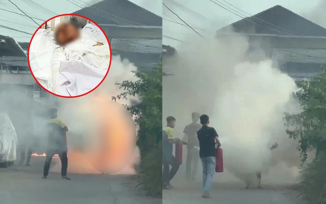 Vụ con trai đổ xăng đốt mẹ: Diễn biến mới về sức khỏe của nạn nhân