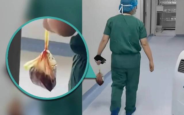 Bức ảnh bác sĩ cầm theo chiếc túi nilon đi giữa hành lang khiến nhiều người rùng mình