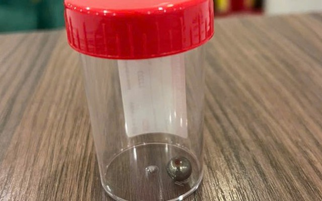 Chơi súng bắn bi, bé trai 5 tuổi bị trọng thương