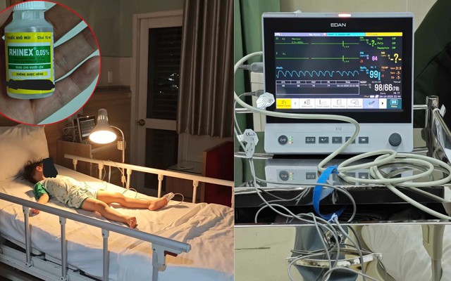 Người mẹ ám ảnh khi con nguy kịch vì lọ thuốc nhỏ mũi, cảnh báo 1 hành động vô ý khiến con suýt mất mạng