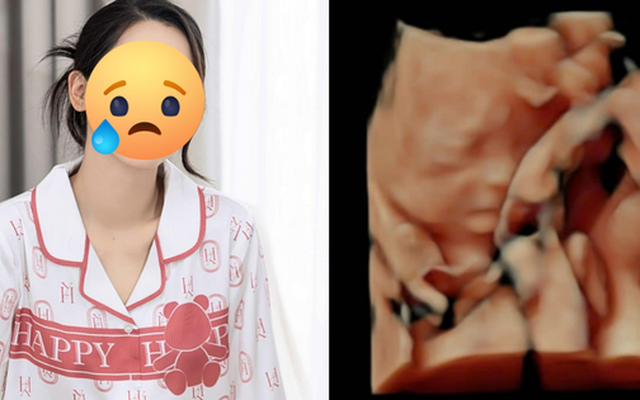 Mẹ bầu Vbiz ám ảnh sau khi làm xét nghiệm: Bị choáng váng đầu óc, nằm 2 tiếng không thở nổi