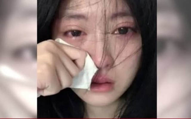 Đăng ảnh khóc quá đẹp, cô gái 19 tuổi bị các web khiêu dâm trộm ảnh để quảng cáo