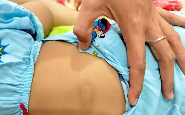 Bình Thuận: Đình chỉ cơ sở giữ trẻ sau vụ bé gái hơn 2 tuổi bị chấn thương "vùng kín"