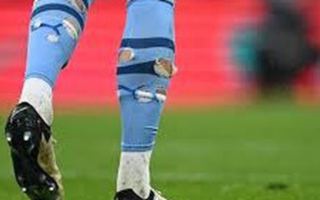 Vì sao các cầu thủ siêu giàu vẫn thích đi tất rách lỗ chỗ như chuột gặm?