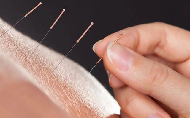 Người đàn ông 47 tuổi phải cắt một bên chân sau khi đi châm cứu