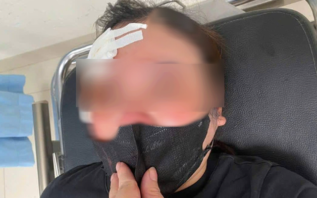 Người phụ nữ đi xe máy "tố" bị tài xế xe bán tải dùng dùi cui vụt vào đầu