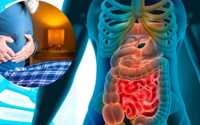 1 dạng ung thư đang tăng mạnh ở người trẻ, nhanh hơn cả ung thư đại trực tràng: Vì sao đáng lo ngại?