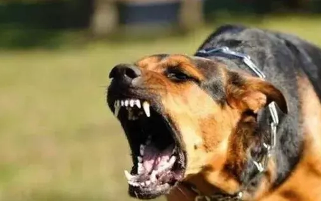 Bé trai 2 tuổi bị chó cắn lộ xương sọ