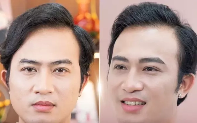 Cả showbiz Việt đi phun chân mày phong thủy cải vận?