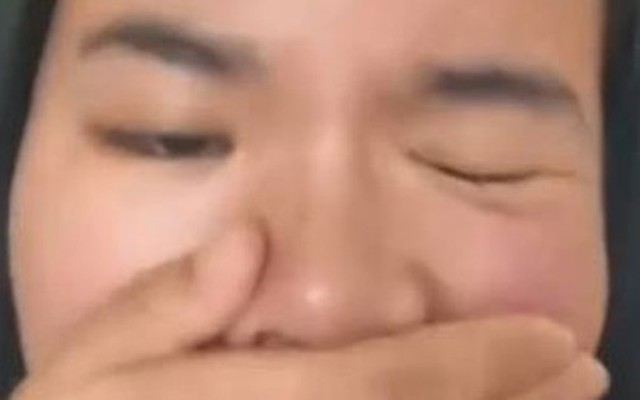 Người phụ nữ 25 tuổi bị liệt mặt sau giấc ngủ trưa, bác sĩ đưa ra cảnh báo