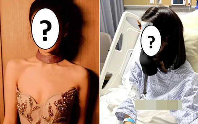 Một nữ diễn viên hạng A phải cắt bỏ túi mật vì sỏi mật, túi mật mất chức năng