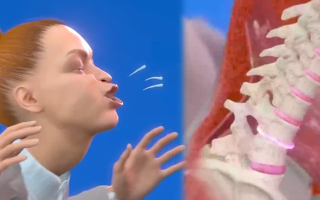 Cơn hắt hơi kinh hoàng khiến người phụ nữ bị liệt gần một năm: Câu chuyện gây ám ảnh trên mạng xã hội!