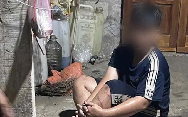 Làm rõ việc nam sinh ở Huế bị người đàn ông xích chân, hành hung