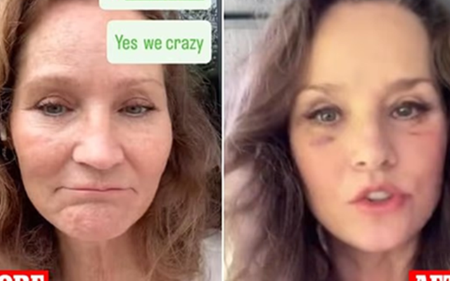 Bà ngoại trông “trẻ ra 20 tuổi” chia sẻ 2 điều hối tiếc lớn nhất sau khi căng da mặt