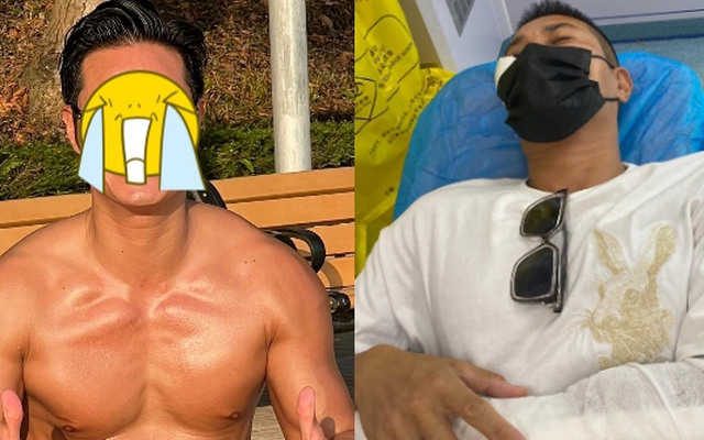 Kinh hoàng vụ nam diễn viên bị "con nghiện" chém trọng thương, phải khâu hơn 100 mũi khắp cơ thể