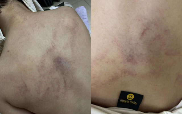 Nóng: Bé gái 4 tuổi bị cô giáo mầm non công lập ở Hà Nội bạo hành dã man, trích xuất camera phát hiện hành động gây sốc