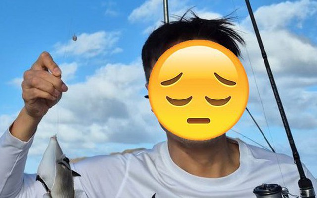 1 nam ca sĩ gây sốc khi tiết lộ não bị biến dạng nghiêm trọng