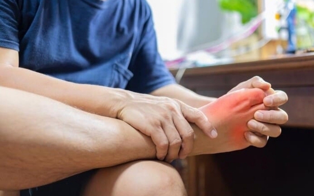 Hai dấu hiệu điển hình của bệnh Chikungunia để phân biệt với sốt xuất huyết