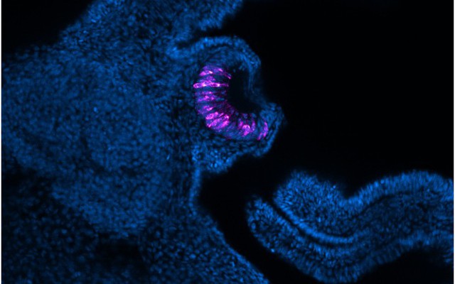 Loài vật có thể "mọc lại" cả nhãn cầu: Phát hiện mới mở kỳ vọng cho y học tái tạo của con người