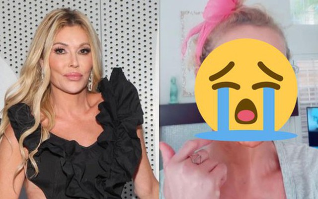 Nữ diễn viên mặt bị "ăn mòn" từng mảng, biến dạng nghiêm trọng vì lí do gì?