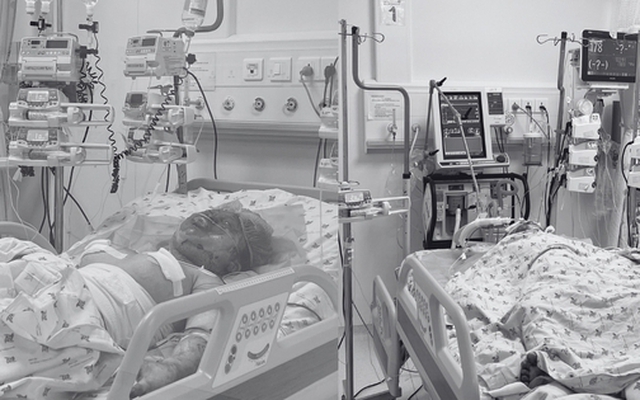 Hai chị em nguy kịch do cha ruột phóng hỏa đốt phòng trọ