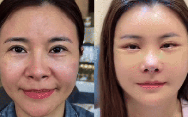 Diễn viên Kim Oanh lên tiếng sau khi gây tranh cãi vì phẫu thuật thẩm mỹ cả gương mặt