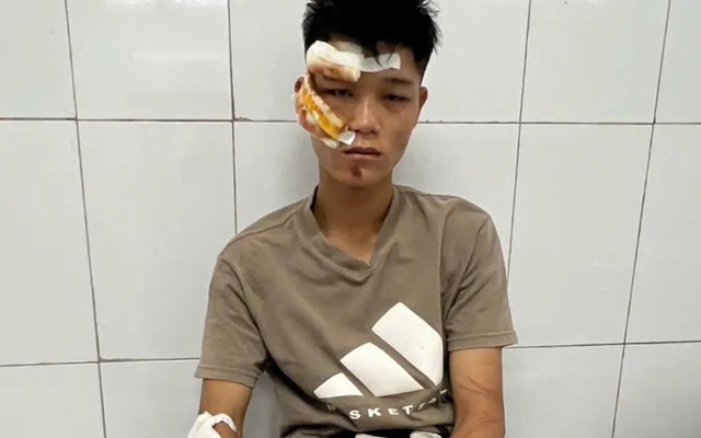 "Quái xế" khóc và khai về việc đi vào đường cấm, tông chiến sĩ cảnh sát cơ động