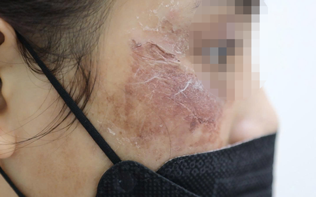 Mỹ phẩm online chưa thôi gây họa