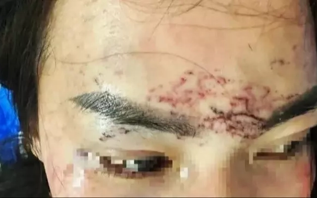 Diễn biến vụ 2 phụ nữ đánh ghen, đổ axit, xăm mặt người khác ở Cà Mau