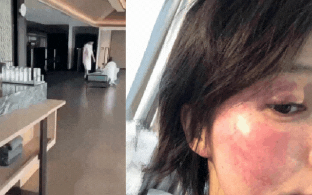 Mỹ nam lộ clip đưa gái lạ đi Phú Quốc bị vợ cũ tố cáo bạo hành đến biến dạng mặt mũi, sảy thai