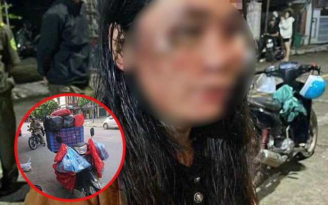 Nữ shipper tố bị vợ chồng chủ nhà đánh nhập viện: Nguồn cơn từ bộ quần áo 900.000 đồng