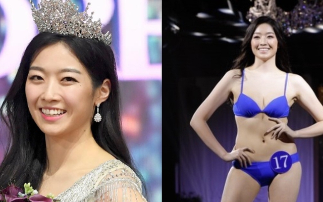 Chuyện gì xảy ra với Hoa hậu Hàn Quốc bị miệt thị ngoại hình?