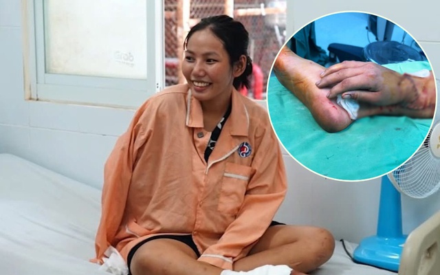 CĐM vỡ òa trước kỳ tích y học Việt Nam: Thai phụ bị tai nạn, được ghép tạm bàn tay đứt lìa vào chân chờ ngày nối lại