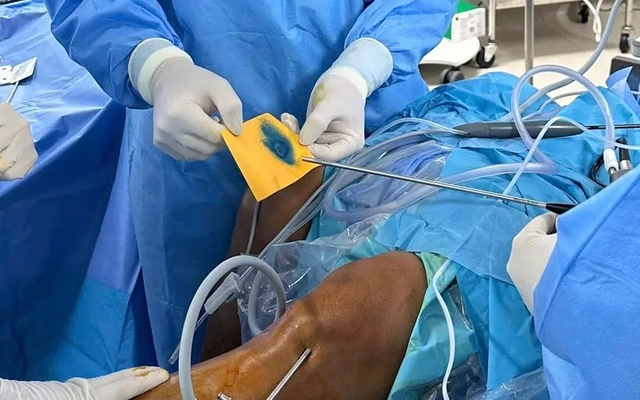 Việt Nam điều trị thành công thoái hóa khớp bằng phương pháp hoàn toàn mới