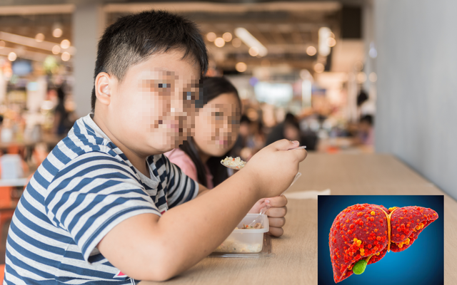 Mới 11-12 tuổi đã mắc mỡ máu, gan nhiễm mỡ, đường huyết 'cao vút': Bác sĩ chỉ đích danh ‘thủ phạm’